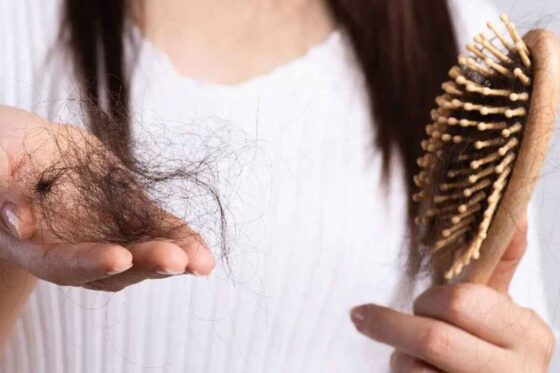 how to stop excess hair fall